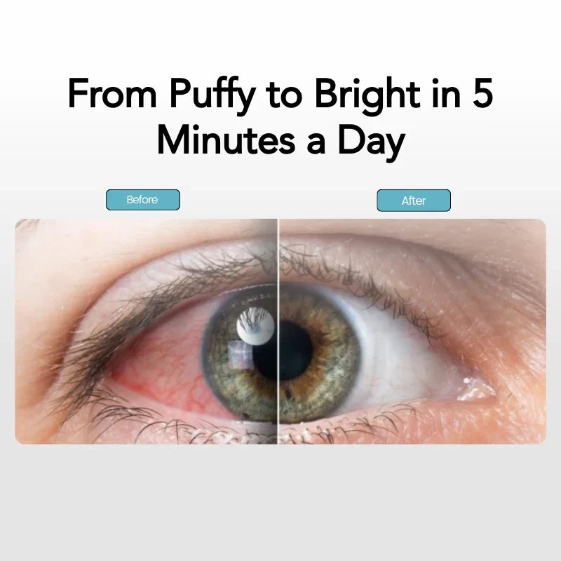 Steamask™ - Dampterapimaske